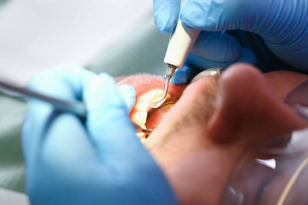 Best Urgent Care for Lost Fillings or Crowns in Itta Bena, MS